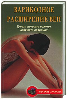 Варикозное расширение вен. Травы, которые помогут избежать операции - Ольга Дмитриевна Абрамович
