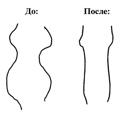 Белые зубы Белые зубы