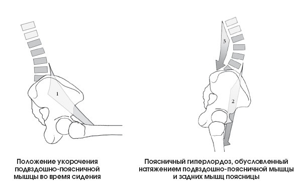 Диагностика и лечение позвоночника. Уникальная система доктора А. М. Уриа