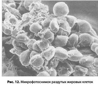 Психология стресса Психология стресса