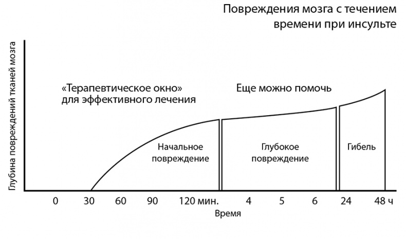 Инсульт. До и после Инсульт. До и после