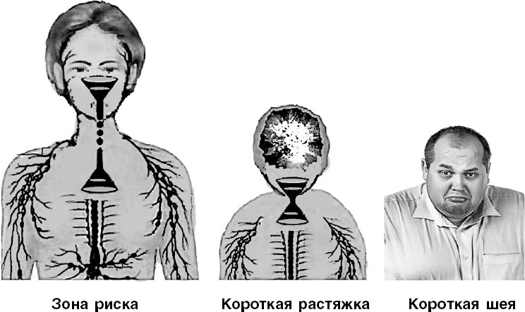 Система Осьмионика. Самомоделирование осанки. Коррекция верхней половины тела Система Осьмионика. Самомоделирование осанки. Коррекция верхней половины тела